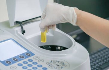 UV Spectrophotometry
